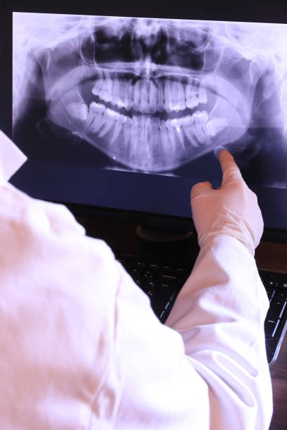 Best Emergency Dental Services for Seniors in University At Buffalo, NY
