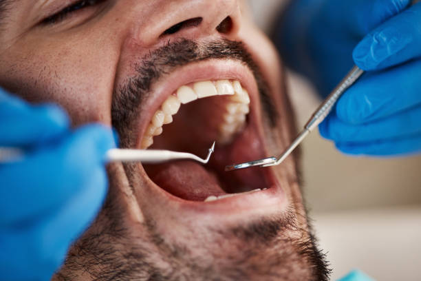 Best Emergency Dentist for Knocked-Out Tooth in University At Buffalo, NY