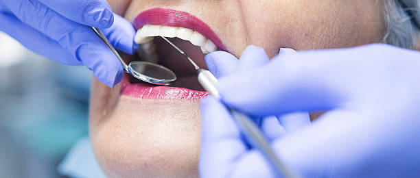 Best Emergency Dental Extractions in University At Buffalo, NY